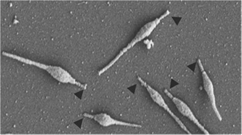 Mycoplasma pneumoniae: Properties, Disease, Diagnosis • Microbe Online