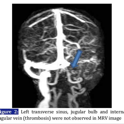 FOCAL DEFICITS/NEUROLOGICAL SIGNS | Download Scientific Diagram