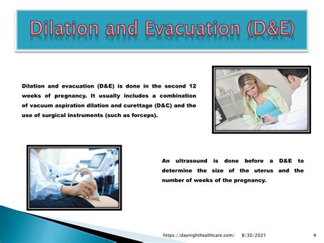 PPT - Dilation and Evacuation – Surgical Abortion Procedure PowerPoint Presentation - ID:10807852