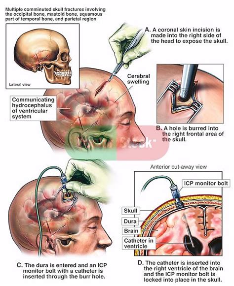 Pin On Nursing