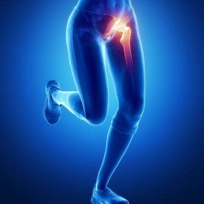 Groin Groin Problems And Injuries Can Cause Pain And Concern