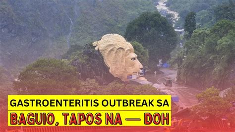 Gastroenteritis Outbreak Sa Baguio Tapos Na — Doh Youtube