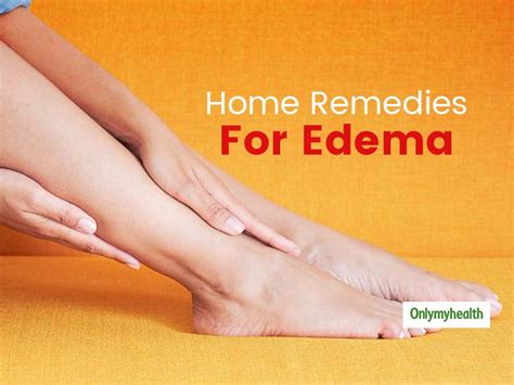 What Is Edema Causes And Treatment Off