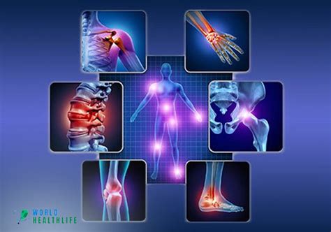 Joint Pain – Symptoms, Causes, Effect And Treatment