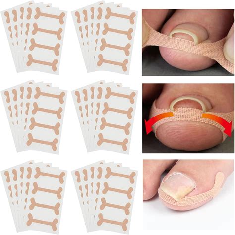 60 Sheet Professional Ingrown Toenail Corrector Patch Elastic Force