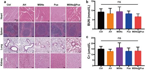 In Vivo Serum And Histopathological Evaluation After Different