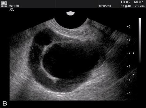 383 best images about OB/Gyn Ultrasound 101 Mod 2 on Pinterest ...