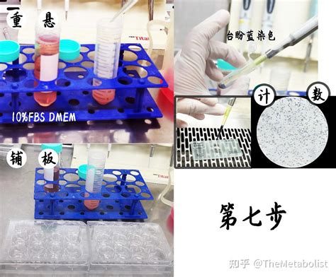 代谢学人 小鼠原代肝细胞提取之实操篇 知乎