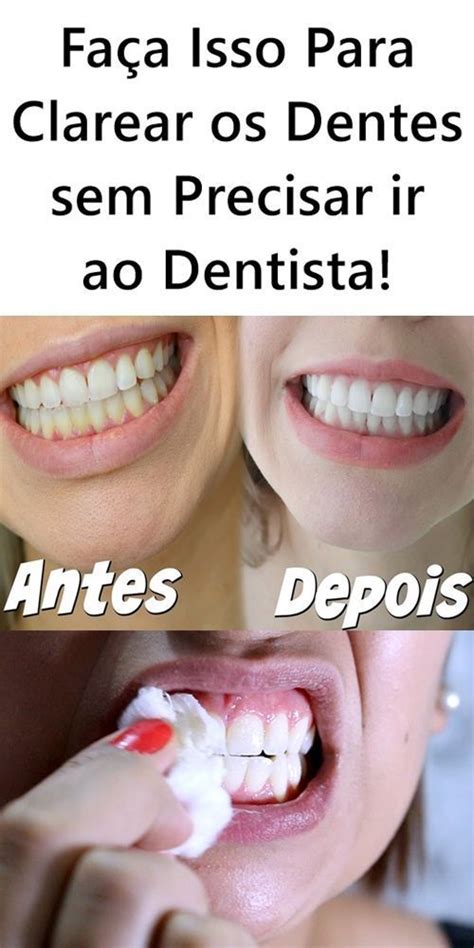 Faça Isso Para Clarear os Dentes sem Precisar ir ao Dentista Clarear