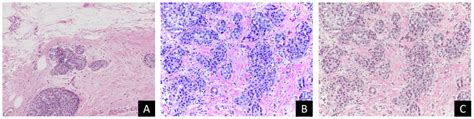 Output Of Stain Normalization A B And C Show The Target Image The