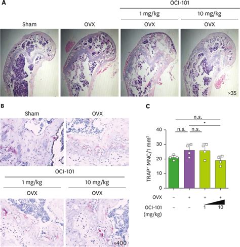 1 3 Dibenzyl 5 Fluorouracil Prevents Ovariectomy Induced Bone Loss By