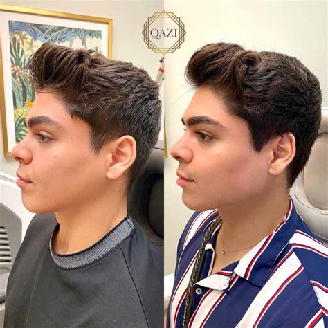 Male Facial Sculpting Qazi Cosmetic Clinic Orange County CA