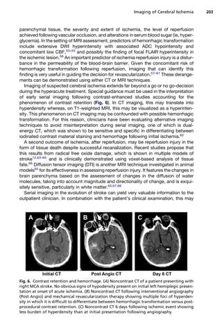 Imaging Of Cerebral Ischemia Pdf