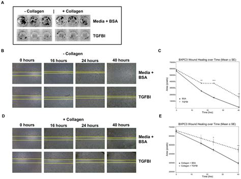 Tgfbi Modulates Growth And Migration Of Bxpc Cells A Exogenous