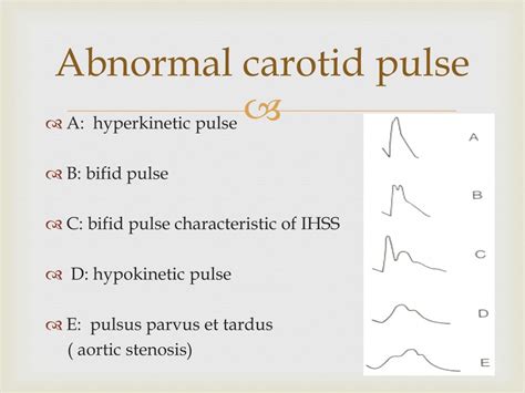 PPT - Jugular Venous Pulse and Carotid Arterial Pulse PowerPoint ...