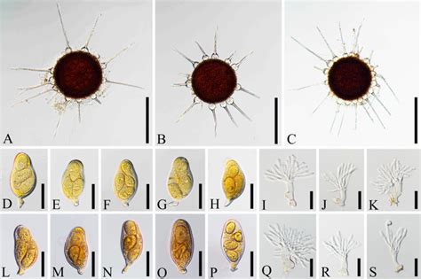 Phylogeny And Taxonomy Of Phyllactinia Species Powdery Mildew