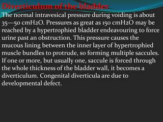 Bladder Stones Fistula Diverticulum Ppt