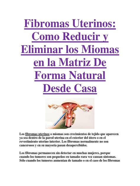 Fibromas Uterinos Como Reducir Y Eliminar Los Miomas En La Matriz De Forma Natural Desde Casa