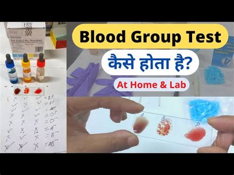 Blood Group Test Kit Blood Grouping Kit Latest Price Manufacturers