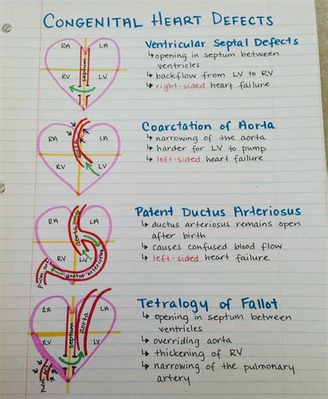 congenital heart defects medizzy