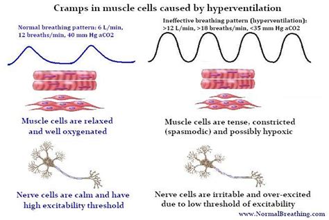 What Cramps Causes in Leg and Other Muscle Spasms?