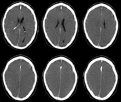 Screenclip La Neuroimagen Flickr