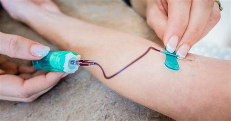 Butterfly Needle for Blood Draw: How It Works and Why It’s Used