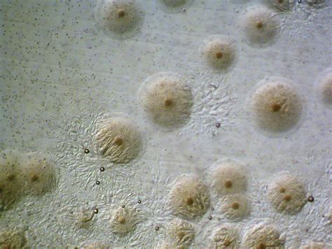 Mycoplasma Pneumoniae Fried Egg Appearance