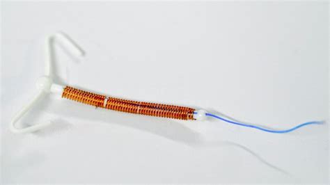 IUD most effective birth control method, Canadian pediatricians declare ...