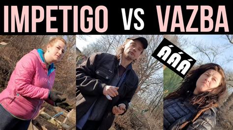 Psychopat Vs Zdeni Ka Jde Do Vazby Al K M Impetigo Youtube