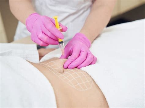 Fat Dissolving Injections Divine Aesthetics And Laser Clinic