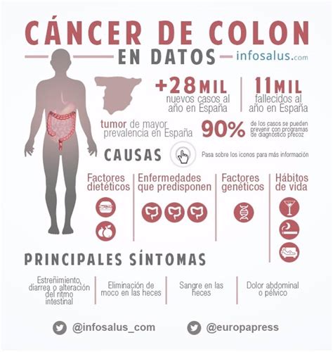 Infografía Las claves del cáncer de colon