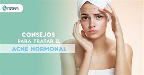 ¿qué Sirve Para El Acné Hormonal Sorel Cuida Tu Piel Productos