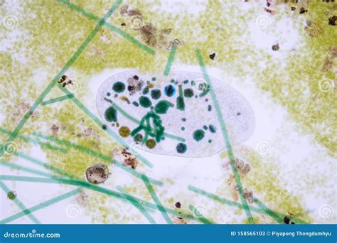 Frontonia Sp. Unicellular Ciliate Protists Under The Microscope. Stock Image | CartoonDealer.com ...