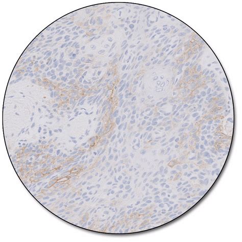 Pd L Ihc C Pharmdx For Autostainer Link Agilent