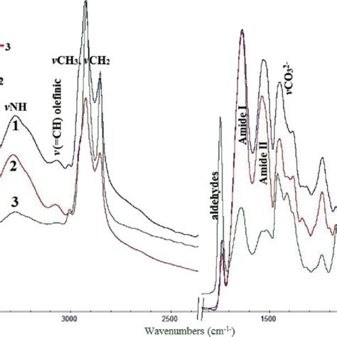 Representative Ftir Spectra Of An Aortic Valve Taken From The Regions