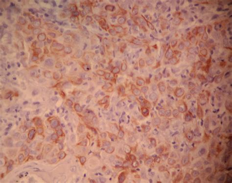 Photomicrographs Of Histopathological And Immunohistochemical Findings Download Scientific