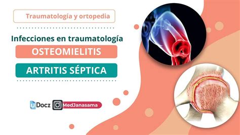 Infecciones En Traumatología Osteomielitis Y Artritis Séptica Med