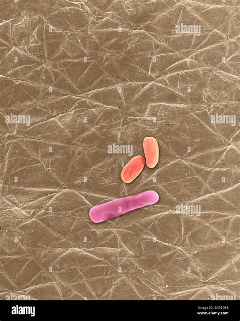 Coloured Scanning Electron Micrograph Sem Of Bacillus Anthracis Spore