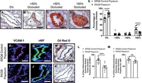 PAR4 Inhibition Reduces Coronary Artery Atherosclerosis And Myocardial