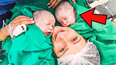 Mother Gives Birth To Twins And Notices That One Of Them Looks Strange Youtube