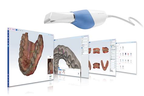 Das Modul Planmeca Romexis Cad Cam Bringt Digitale Abdr Cke Auf Ein