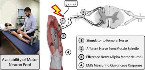 Formal Assessment Of Arthrogenic Muscle Inhibition LIVE4 Sports