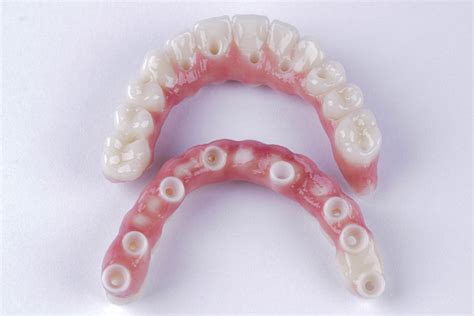 What Is The Effectiveness Of Zirconia Restorations Av Periodontics