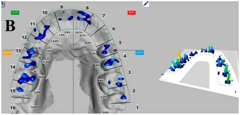 Applied Sciences Free Full Text Digital Occlusion Analysis After