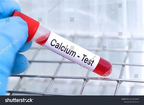 Calcium Test Look Abnormalities Blood Blood Stock Photo 2232678467 ...