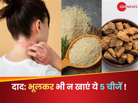 Skin Infection खुजली और दाद खाज से परेशान हैं भूलकर भी न खाएं ये 5 चीजें