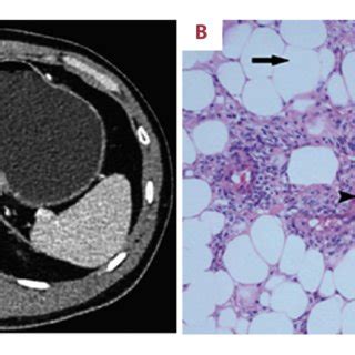 Case 1 A Contrast Enhanced Axial Computed Tomography CT Scan Of