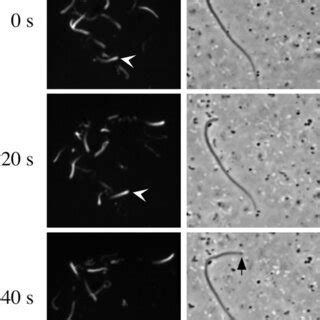 Reconstitution Of PMA Stimulated Actin Assembly In Vitro A