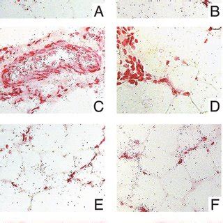 Brightfield View Of In Situ Hybridization For 11 HSD 1 MRNA In Adipose